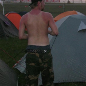 Ein klein wenig Sonnebrand gefällig? (NovaRock ´08)