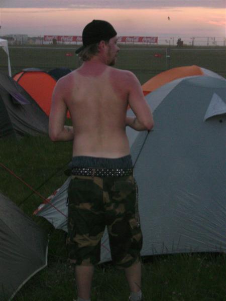 Ein klein wenig Sonnebrand gefällig? (NovaRock ´08)